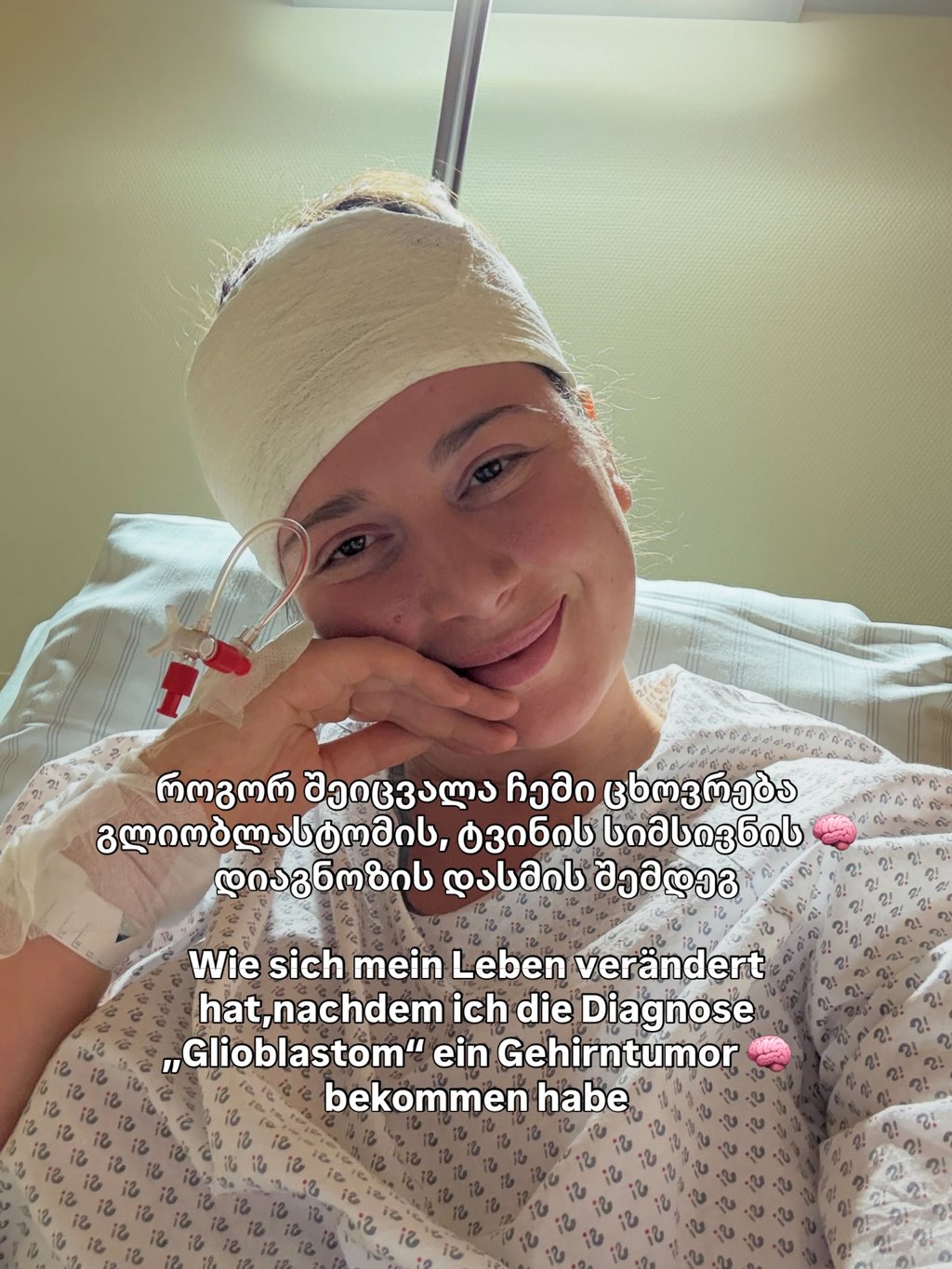 ანი ფურცელაძე