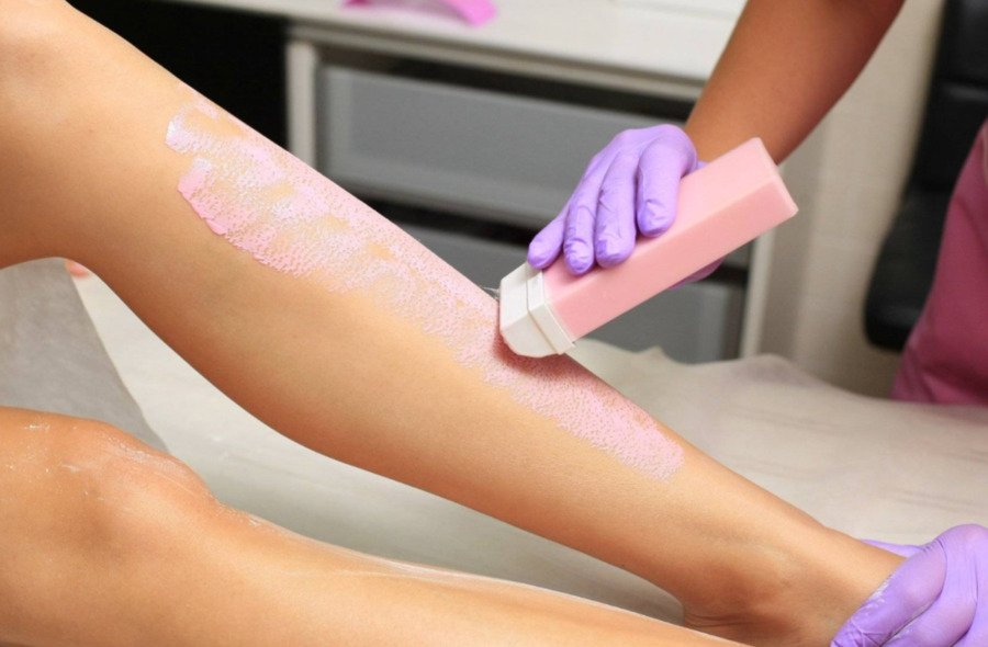 დეპილაცია